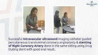 Patient testimonial | Angioplasty