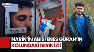 Narin'in Ağabeyi Enes Güran'ın Kolundaki İzlerin Görüntüleri Ortaya Çıktı!