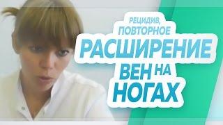 Рецидив варикозной болезни, повторное расширение вен на ногах. Флебологический центр "Антирефлюкс"