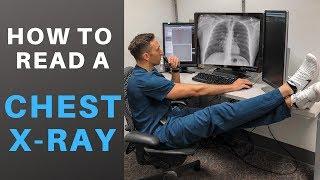 How to Read a Chest X-ray like a Radiologist!  (My Search Pattern)