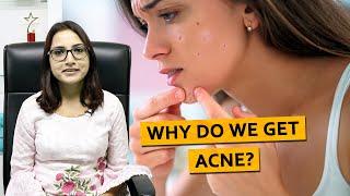 Why do we get ACNE? | Dr. Deepika Lunawat