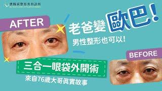 【三合一眼袋外開術】76歲的大哥終於拿掉困擾很久的眼袋