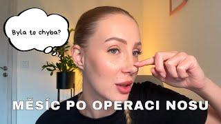 MĚSÍC PO OPERACI NOSU | jsem šťastná nebo toho lituju?