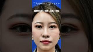 鳳凰電波、美國音波案例分享｜晶華美醫診所｜晶心美醫集團