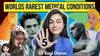 Worlds RAREST medical conditions | Dr Ezgi Ozcan