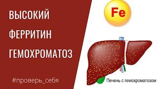 Высокий ФЕРРИТИН. Накопление ЖЕЛЕЗА в печени/ суставах/ коже. Анализы. ГЕМОХРОМАТОЗ