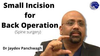 Small incision spine operation. Dr Jaydev Panchwagh. Spine surgeon Pune. 2021