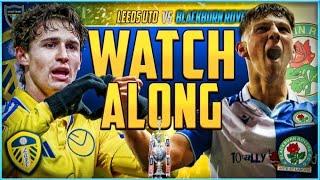 Leeds United v Blackburn Rovers Live Stream Watchalong!