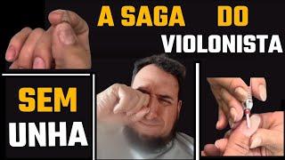 || Vlog || A Saga de Um Violonista com a Unha Quebrada