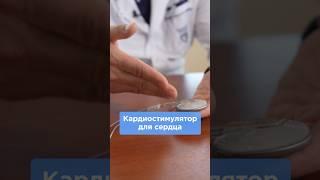 Как работает кардиостимулятор на сердце? #кардиостимулятор #сердце #аритмия