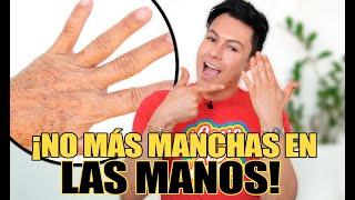 Evita las arrugas y manchas en las manos con estas 5 cremas