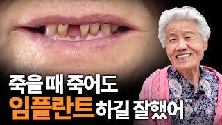 죽었던 사람이 살아났어요 [임플란트 후기 #4]