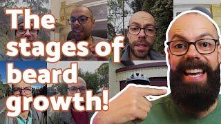 Growing a beard: stages WITH PICTURES | Every embarrassing stage with tips!