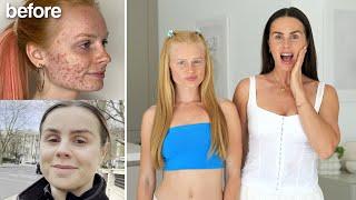 HOW WE QUIT SUGAR! Mother & Daughter Glow Up