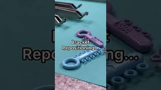 Orthodontic Bracket Repositioning -