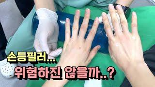 손등필러 시술 후 주의할 점은? 마르고 주름진 손 관리법ㅣ모즈의원- 손승용원장