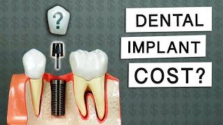 How Much Do Dental Implants Cost?