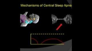 Understanding Mechanisms of Central Sleep Apnea - BAVLS