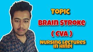 Cerebrovascular Accident (CVA)- Brain Stroke ( Nursing Lectures in Hindi MSN 2 )