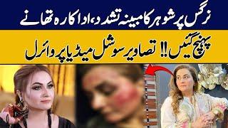 Alleged Violence Of Husband On Nargis | GNN Entertainment