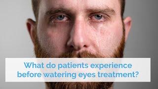 What do patients experience before watering eyes treatment?