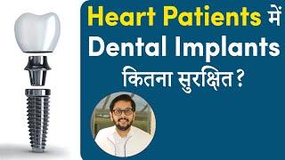 क्या Heart Patients Dental Implants द्वारा फिक्स दांत लगवा सकते है? |Dr. Ankit Khasgiwala | Seraphic