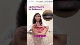 How to get rid of dark lips | Lighten dark lips | How to get SOFT & HEALTHY LIPS