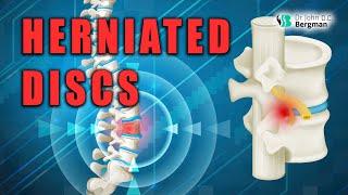 Herniated Discs - Causes & Solutions 