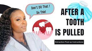 2023 Dentist gives Best Advice for After a Tooth is Pulled (Extracted) to Heal Better