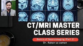 Basics of Neuroimaging part 2  CT/MRI Master class series