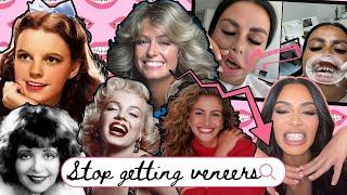 Why Hollywood Veneers Are Out: The Rise of Natural Beauty in Teeth: A Beauty History