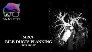 MRCP BILE DUCTS PLANNING. "HOW I DO IT"