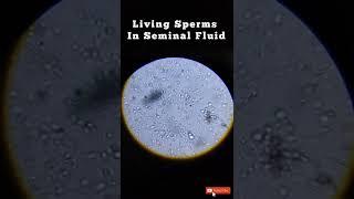 Human Sperm in Living Stage #biology #zoology #viralvideo #neet #viralshorts #neet #bsc