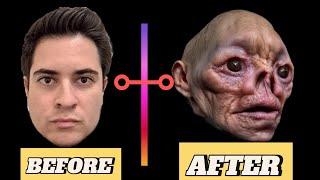 Surgeries Go Horribly Wrong: Shocking Transformations!