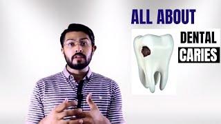 Dental Caries explained EASY