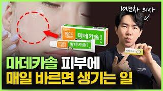 마데카솔 정말 피부 좋아지는 데 효과가 있을까?ㅣ10년차 의사가 알려드립니다! 마데카솔 케어, 마데카솔 겔, 마데카솔 분말 관리법의 효과가 궁금하시다면 이 영상을 꼭 확인하세요!