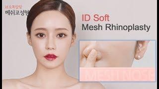 Korea Rhinoplasty Before And After l ID Hospital Korea