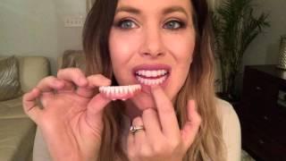 New Phonares Hybrid Dentures! Part 1