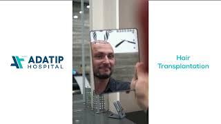 Hair Transplantation | Adatip Hospital