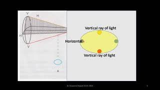 Sturm's Conoid made simple for Medical Undergraduate students by Dr Anupama Bappal