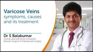 Varicose Veins - Symptoms,Causes and Treatments Explained By Dr S Balakumar - Vascular Surgeon