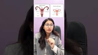 Endometriosis vs Adenomyosis: Understanding, Fertility Impact & Ayurvedic Treatment | Dr Shivani