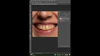 How To Whiten Teeth #photoshop #tutorial