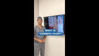 Celebrity Edition: Ozempic Face | Zuri Plastic Surgery