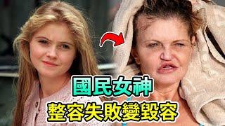 英國女星整容失敗全臉毀容！鼻子塌陷一只眼失明，嚇跑小男友！50歲面目全非星途全毀 #DanniellaWestbrook #Boogie島