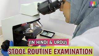 Stool Routine Examination (Urdu & Hindi). MLT WORLD.