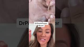 Dr Pimple Popper Reacts to Restaurant Pop!