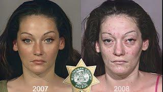 Drug addiction is a problem in our world.Photos that clearly show all the horror and harm of drugs.