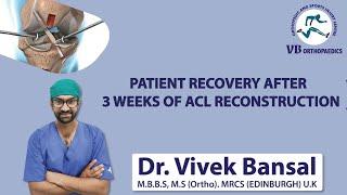 ACL Ligament #Knee Injury #Keyhole Surgery #Best Knee Surgeon #Dr Vivek Bansal