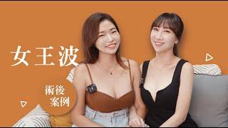 女王波隆乳術後2個月分享【晴姐姐】一從手術到自信滿滿的蛻變之路｜台北台南高雄隆乳專家元和雅整形外科診所 #女王波 #隆乳 #台南隆乳 #台南女王波